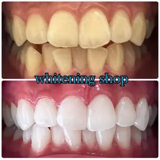 ホワイトニング ショップ吉祥寺店のエステ・リラクイメージ