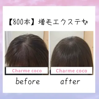 ミディアム カラー ヘアアレンジ メンズ 肌質改善Charme coco  増毛のエステ・リラクイメージ
