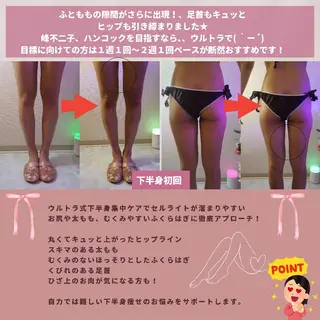 痩身ハーブピーリング 筋膜リリース☆B&Hのエステ・リラクイメージ