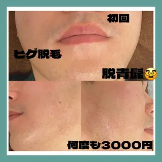 メンズ 【光＆WAX脱毛】セラヴィプライベートサロン（メンズ・キッズも可）所属・kaise makiのエステ・リラクイメージ