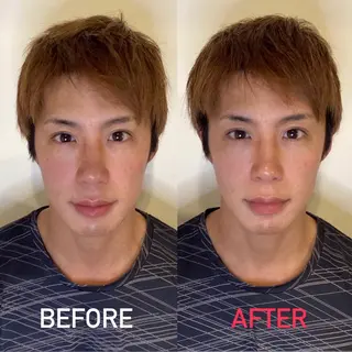 メンズ パーソナルカウンセラー付き:メンズセルフ脱毛・セルフホワイトニング専門店 ズボコスサロン笹塚所属・パーソナルセルフ脱毛 ズボコスサロンのエステ・リラクイメージ