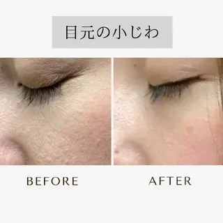 ICHOOSE/ 代々木上原のエステ・リラクイメージ