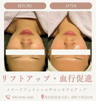 メナードフェイシャルサロンキラビアップ所属・肌改善・美肌サポート 🤍tokoのエステ・リラクイメージ