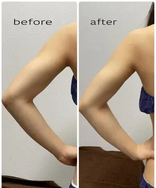 ENCHANT 脱毛.小顔.毛穴のエステ・リラクイメージ