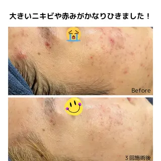 leolo武蔵浦和 肌質改善＆脱毛のエステ・リラクイメージ