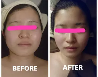 TIERRA(ティエラ)所属・TIERRA ♡のエステ・リラクイメージ