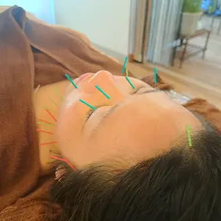 鍼灸サロンmiyabi所属・美容鍼×エステ　鍼灸 サロンmiyabiのエステ・リラクイメージ