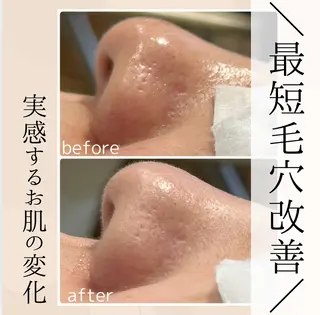 小顔・毛穴・たるみ ネイル　似内真樹のエステ・リラクイメージ