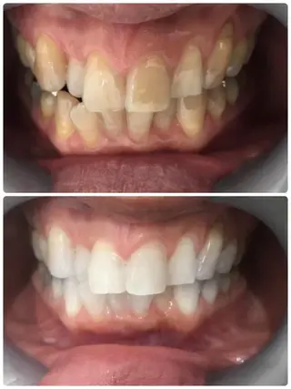 Monreve所属・美人スイッチdiet スーパージェクションのその他イメージ