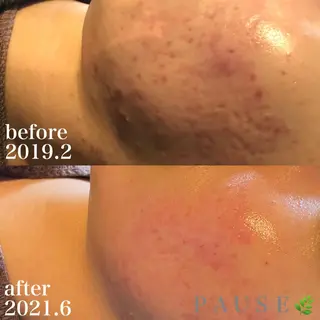 浜野 恵美のエステ・リラクイメージ