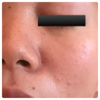 フェアリーローズ所属・fairyrose organicエステのエステ・リラクイメージ