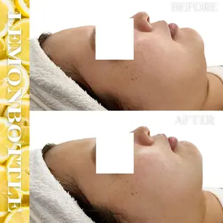 Liam《美肌管理/ 3D小顔/脂肪ケア》のエステ・リラクイメージ