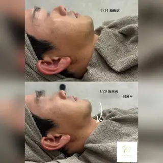 心斎橋🤍堀江.小顔 ハーブ.痩身クレビアのエステ・リラクイメージ