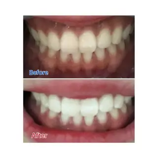 M渋谷店所属・M渋谷 ホワイトニングのエステ・リラクイメージ