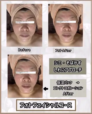 ヴィーナス ビューティーのエステ・リラクイメージ