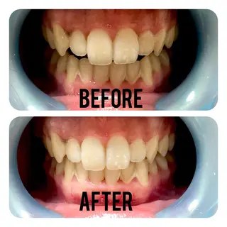 two nailのネイルデザイン