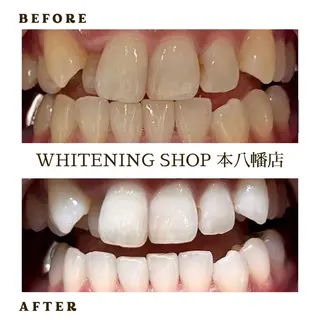 メンズ ホワイトニング ショップ本八幡店のエステ・リラクイメージ