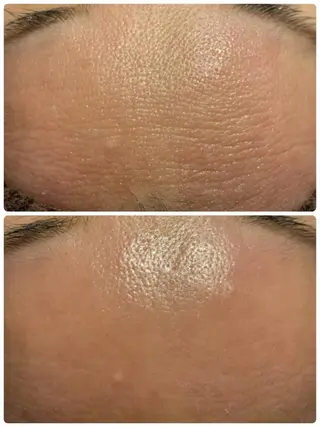 aimee　肌質改善サロン【アイミー】所属・肌質改善サロン aimee｜アイミーのエステ・リラクイメージ