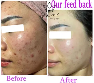 Mia beauty所属・MiA Beautyのエステ・リラクイメージ