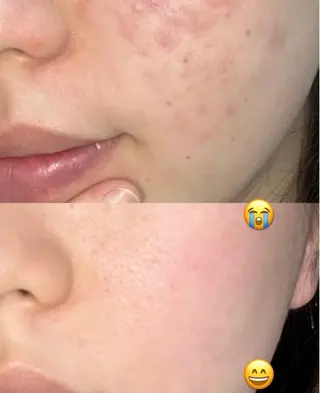 ネイル aliaハイフ&水光ジェットサロン所属・aliaハーブ水光店 エステティシャン募集のエステ・リラクイメージ