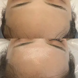 韓国🇰🇷価格 サロン_Nbibiのエステ・リラクイメージ