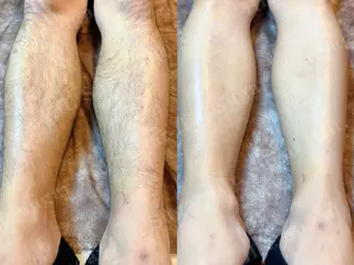 Hit. シュガーリング豊橋のエステ・リラクイメージ