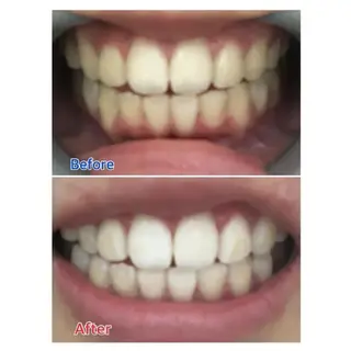 M渋谷店所属・M渋谷 ホワイトニングのエステ・リラクイメージ