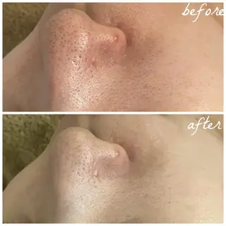 メンズ メナード岐阜市茜部 杉浦のエステ・リラクイメージ