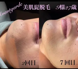 メンズ 【an.g（アン.ジー）】脱毛/フェイシャル/痩身所属・フェイシャル/脱毛 an.gアン.ジーのエステ・リラクイメージ