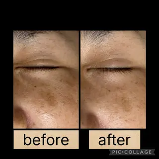 DeI'm柴田所属・【肌質改善サロン】 Harunaのネイルデザイン