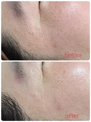 relaxation Stolzのエステ・リラクイメージ