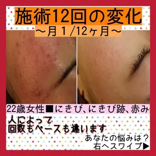 ミディアム カラー パーマ ヘアアレンジ メンズ キッズ ネイル マツエク・マツパ ニキビ・肌質改善専門 ♡人生が変わるサロンのエステ・リラクイメージ