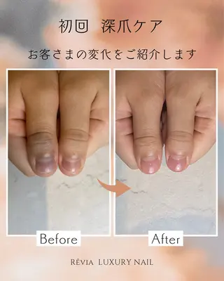 ネイル プライベートサロン Rのネイルデザイン