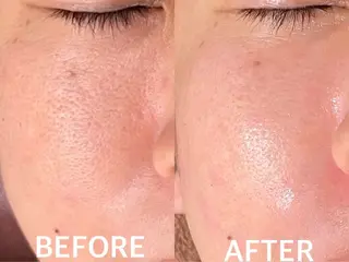 ハーブピーリング 横浜のエステ・リラクイメージ