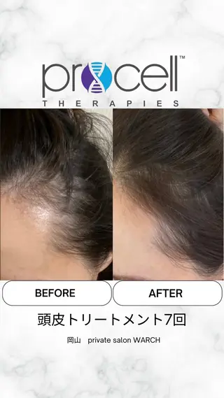 WARCH Marieのその他イメージ