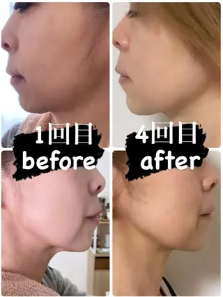 【痩身・脱毛サロン】 REBISKIN🌱のエステ・リラクイメージ