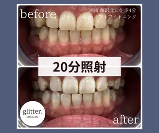 ネイル glitter.SHONAN所属・ホワイトニング専門店 glitterのその他イメージ