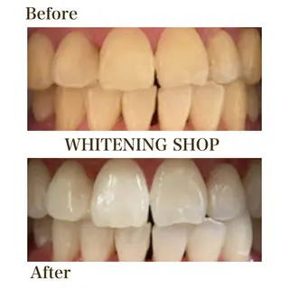 セルフホワイトニングショップ静岡葵区店所属・もえか静岡葵区店ホ ワイトニングショップのその他イメージ