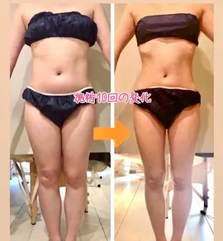 ショート カラー パーマ ヘアアレンジ メンズ キッズ ネイル マツエク・マツパ ‍痩身＆ボディ 結果出し🌟丹野のエステ・リラクイメージ