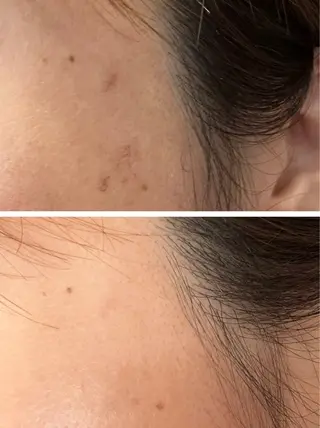 大阪大東市 / 体質・肌質改善サロン アンシャンテ所属・体質・肌質改善サロン アンシャンテのエステ・リラクイメージ