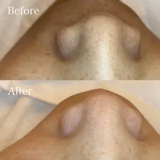 EARTH coiffure beaute 新潟紫竹山店所属・🤍アベシュリ /フェイシャル🤍のエステ・リラクイメージ