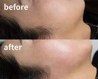 松下 佳織の眉毛・アイブロウイメージ