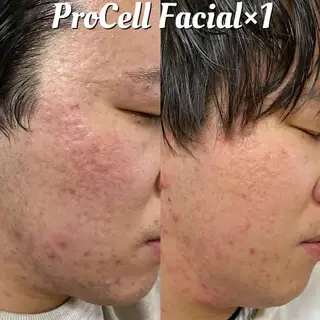 Blooming所属・LOUISE. ／肌質・頭皮のエステ・リラクイメージ