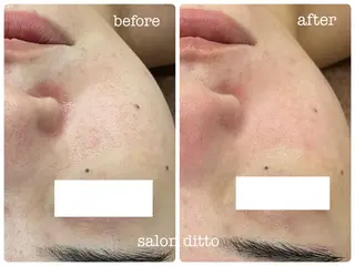 salon ditto所属・mio (小顔・ヘッドスパ)のエステ・リラクイメージ