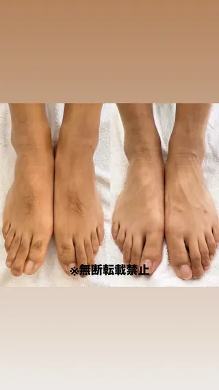 メンズ キッズ 親子脱毛サロンReOlu所属・親子脱毛サロン ReOluのエステ・リラクイメージ