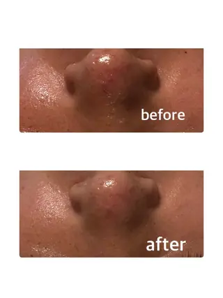 Lulu estheticsalon所属・Lulu 　田村 梨乃のエステ・リラクイメージ