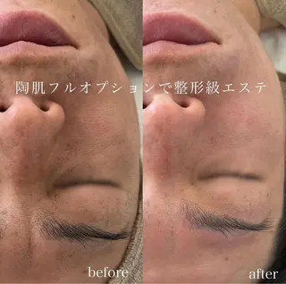 blan. beauty salon所属・blan. /岡本/ 神戸ハーブピーリングのエステ・リラクイメージ