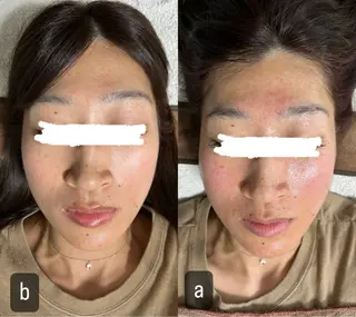 217whitening  room所属・217 ホワイトニングルームのエステ・リラクイメージ