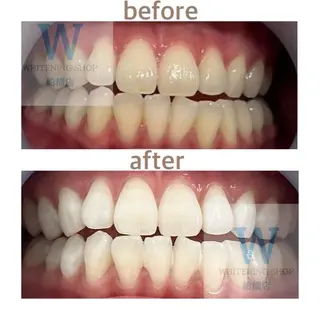 ホワイトニング ショップ船橋２号店のエステ・リラクイメージ