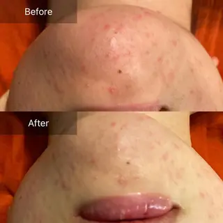 Mandarin Orange所属・毛穴から始める肌メン テマンダリンオレンジのエステ・リラクイメージ